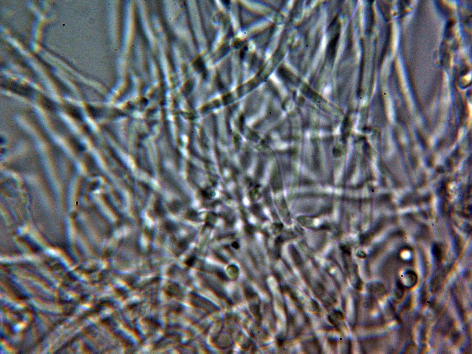 Microscopía de Niemelaea consobrina - 10 hifas en KOH